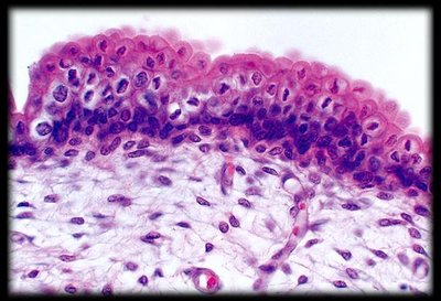 Transitional epithelium under microscope