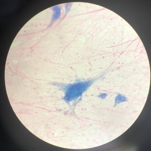 Nervous tissue under microscope
