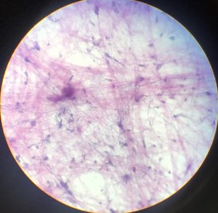 Areolar connective tissue under microscope