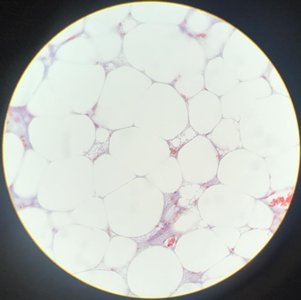 Adipose connective tissue under microscope