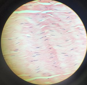 Dense regular connective tissue under microscope