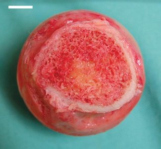 Photograph of red and yellow bone marrow in a femur