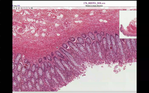 Histology slide showing goblet cells and mucosal structure