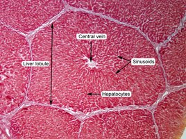 Liver histology showing central vein, sinusoids, and hepatocytes