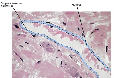 Simple squamous epithelium in venule