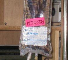 IV bag labeled Pitocin (synthetic oxytocin)