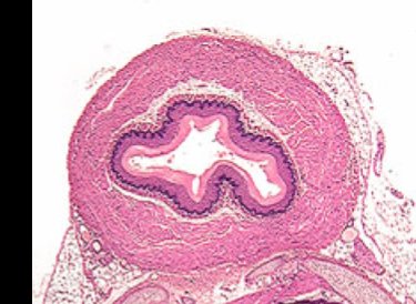 Cross section of esophagus showing tissue layers