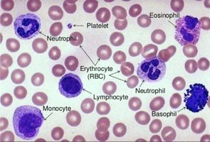 Blood smear showing platelet and neutrophil