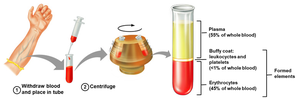 Blood centrifugation showing plasma, buffy coat, and erythrocytes