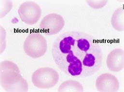 Blood smear showing neutrophil and platelet