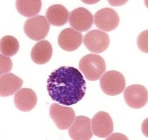 Blood smear showing basophil