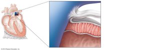 Pericardial layers and heart wall structure
