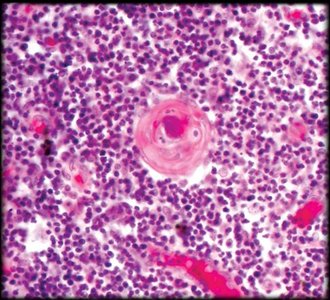Histology slide with circular structure (Hassall's corpuscle)