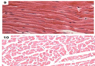 Longitudinal and cross sections of skeletal muscle tissue