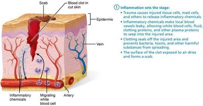 Inflammation in tissue repair
