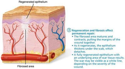 Regeneration and fibrosis in tissue repair