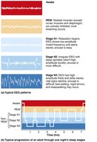 Types and stages of sleep