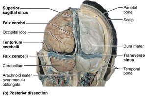 Dural septa and dural venous sinuses, posterior dissection
