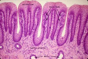 Histological section of tongue showing taste buds within foliate papillae