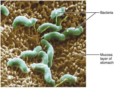 Helicobacter pylori bacteria in stomach mucosa