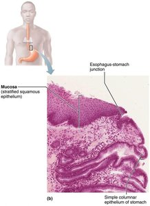 Esophagus-stomach junction showing epithelial transition