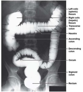 Anatomical landmarks of the large intestine