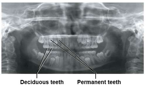 X-ray showing deciduous and permanent teeth