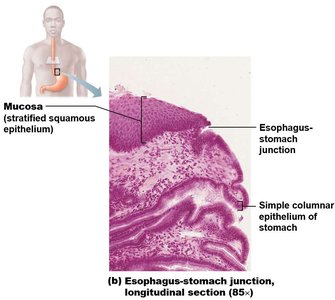 Histological section of the esophagus-stomach junction
