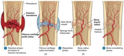 Phases of bone repair