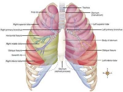 Diagram of pneumothorax showing air in pleural space