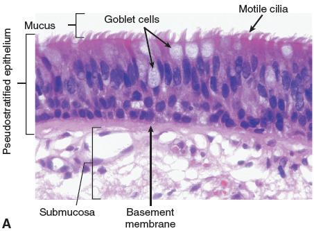 Histological section of respiratory mucosa showing cilia and goblet cells
