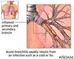 Bronchial tubes
