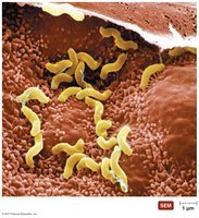SEM of Helicobacter pylori colonizing stomach lining