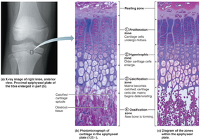 Zones of the epiphyseal plate
