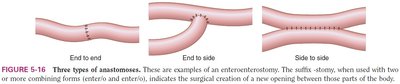 Types of anastomoses