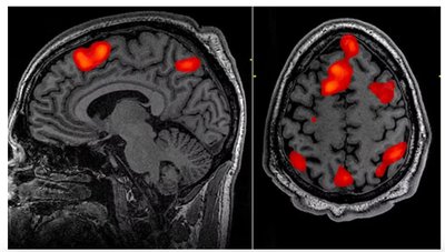 fMRI showing BOLD response in brain