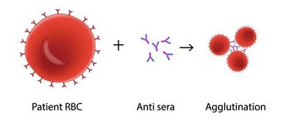 Agglutination reaction: RBCs and antibodies