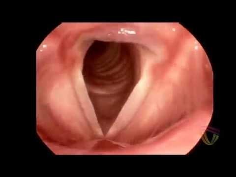 Anatomy of the trachea and bronchial tree