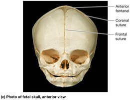 Fetal skull: anterior view with fontanels