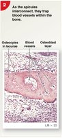 Intramembranous ossification: spicule formation