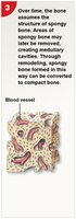 Intramembranous ossification: spongy bone structure
