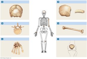 Bone classification diagram