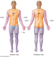 Rule of nines for burn assessment