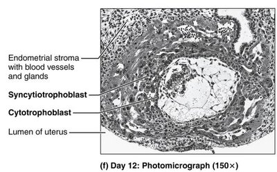 Photomicrograph of implantation site