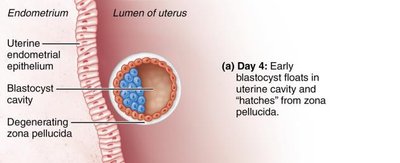 Blastocyst hatching from zona pellucida