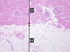 Histological section showing dermis and hypodermis