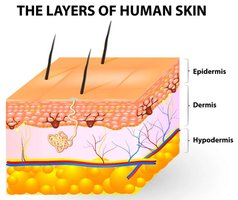 Diagram showing the layers of human skin: epidermis, dermis, hypodermis