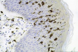 Histological image showing dendritic (Langerhans) cells in the epidermis