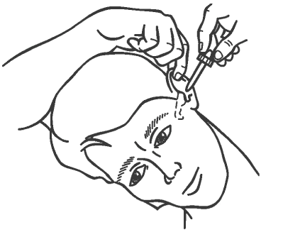Pulling ear backward and upward for ear drops