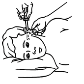 Pulling ear backward and downward for ear drops